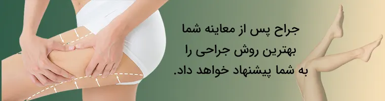انواع روش های جراحی لیفت ران