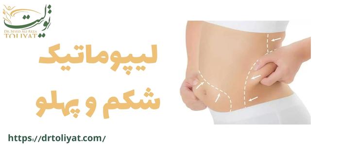 لیپوماتیک شکم و پهلو