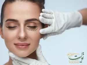 اقدامات قبل از بلفاروپلاستی