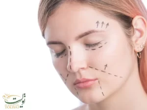 هزینه لیفت صورت در سال 1402