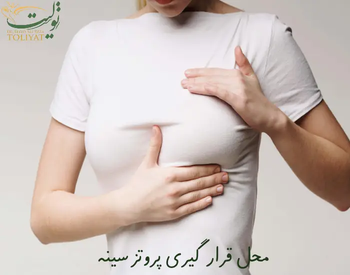 محل قرار گیری پروتز سینه