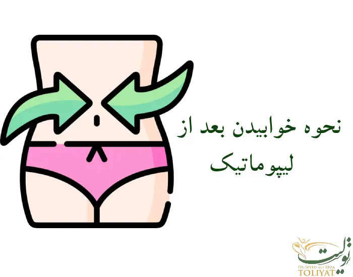 نحوه خوابیدن بعد از لیپوماتیک