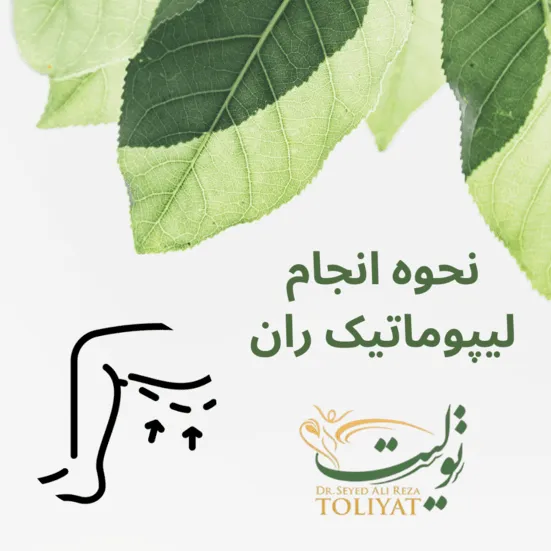 لیپوماتیک ران
