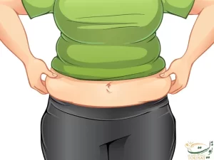 تفاوت لیپوماتیک با ابدومینوپلاستی